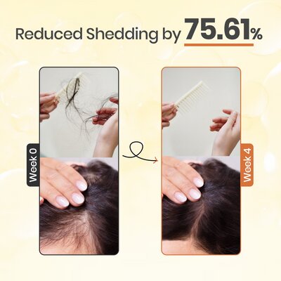 Yoki™ | Hair Growth Serum