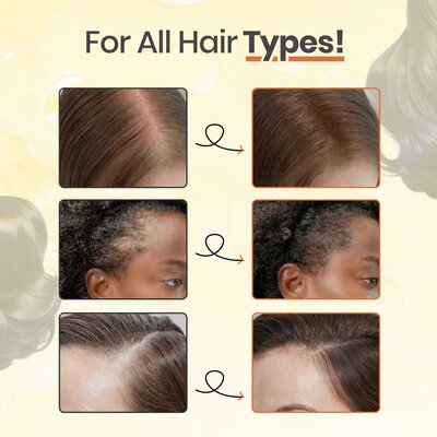 Yoki™ | Hair Growth Serum